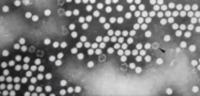 original-electron-microscope-image-of-polio-virus
